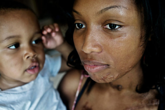 G.M. Prepares to Count Cost of Suffering